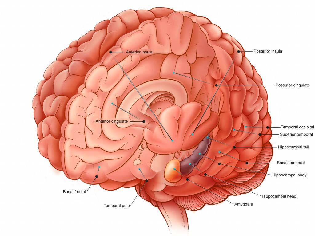 A color illustration of brain showing locations for inserting sereotaxic depth electrodes for electroencephalograph (EEG) monitoring