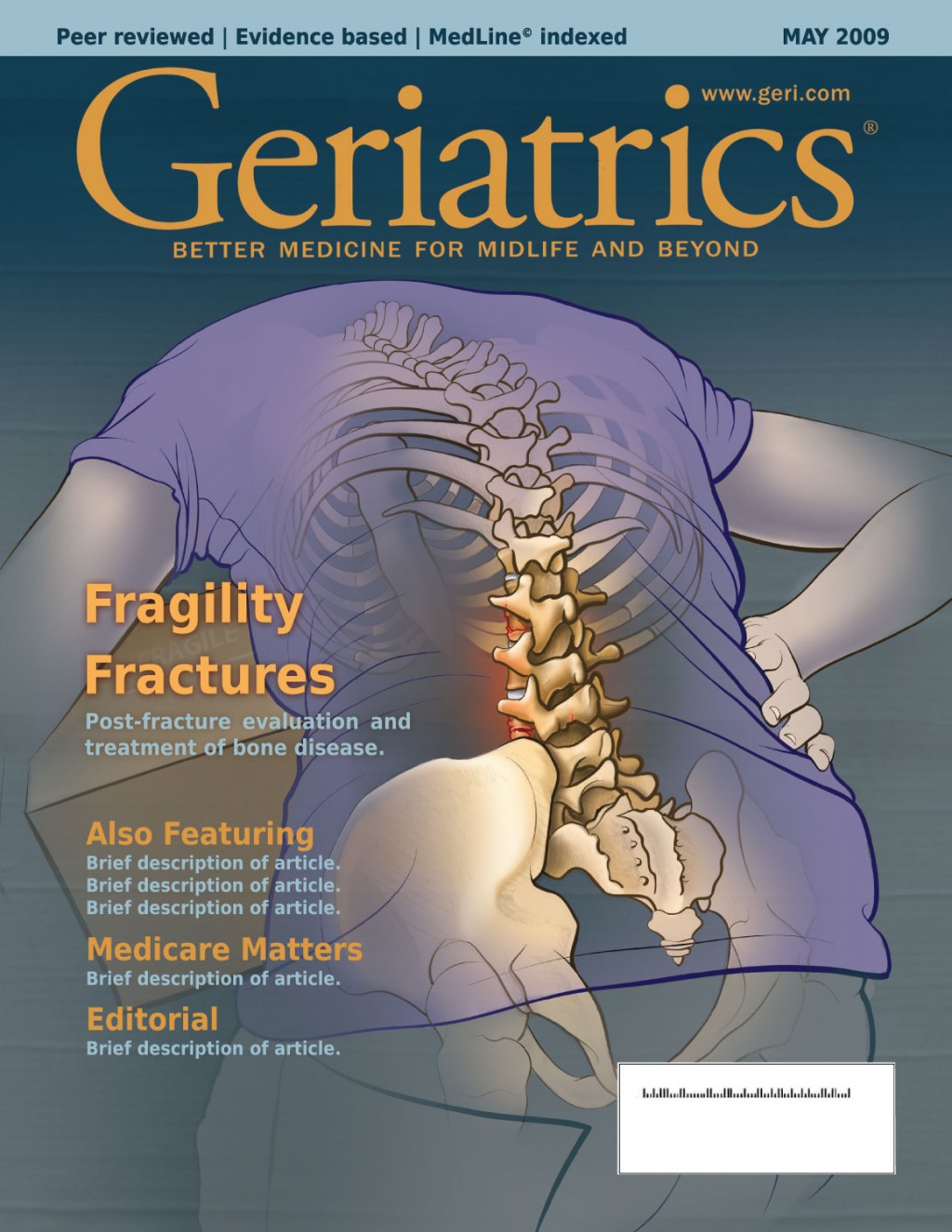 Geriatrics Magazine Mock-up. With a full-color illustration showing a fragility fracture in an elderly patient.